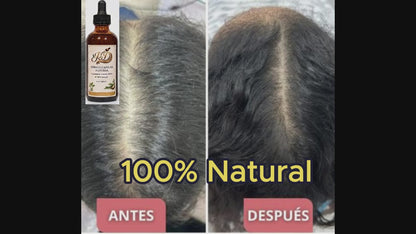 Gotero Natural - Anticaida
